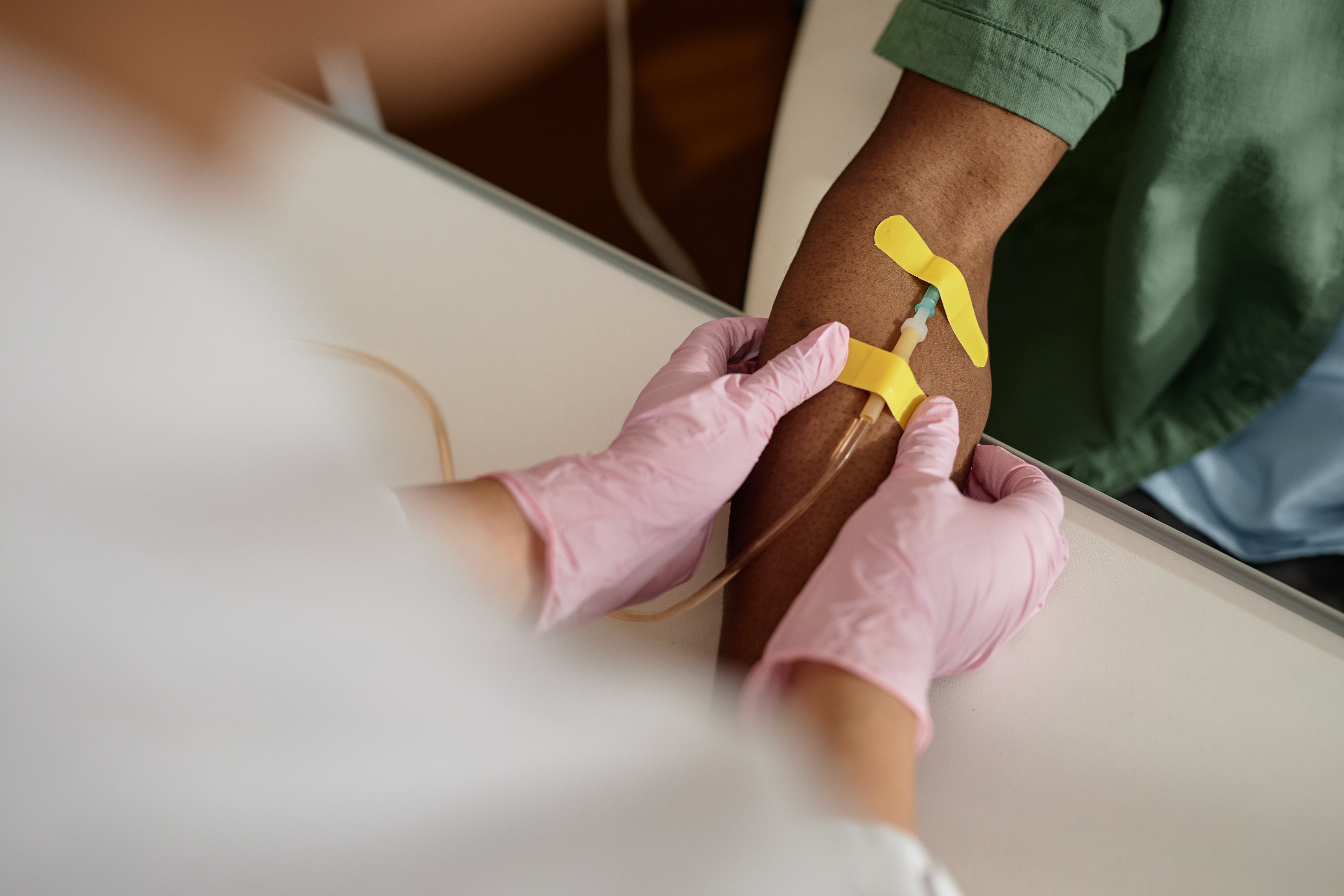 Close up view of a patient's arm receiving chemotherapy treatment with a nurse's hands assisting in care.
