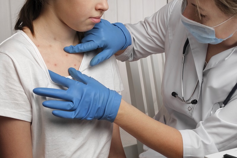 Doctor looking at the skin of a young girl with measles rashes.