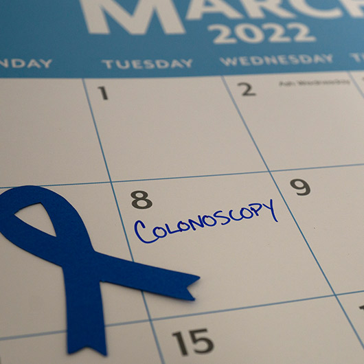 Calendar showing colonoscopy appointment