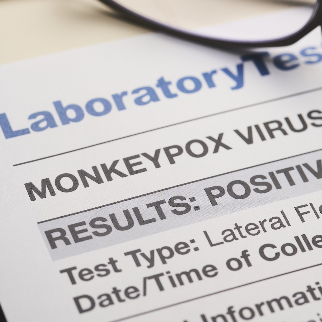 Lab test for monkey pox