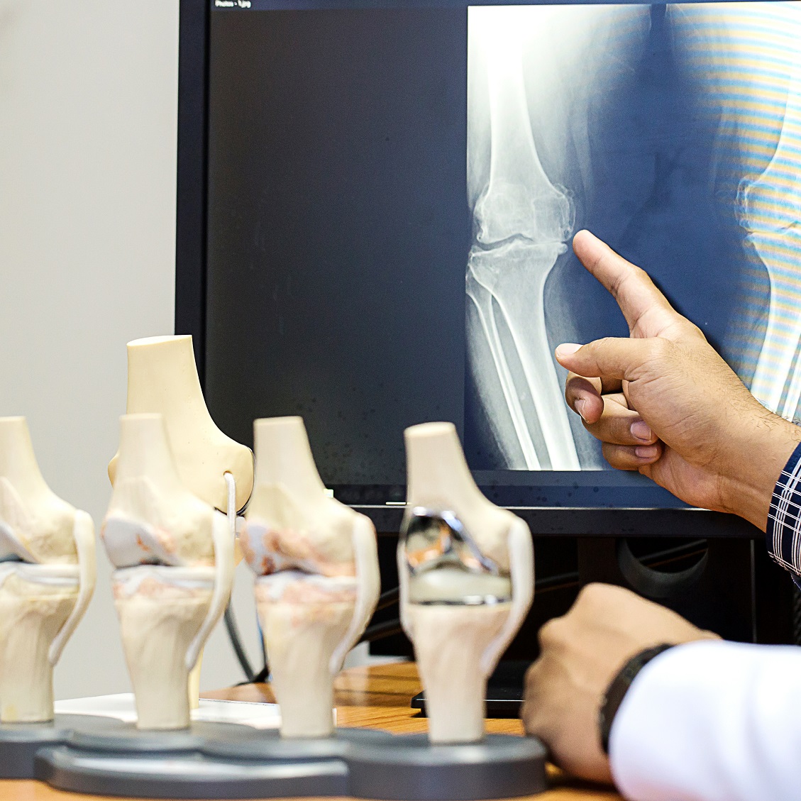 Knee models and x-ray