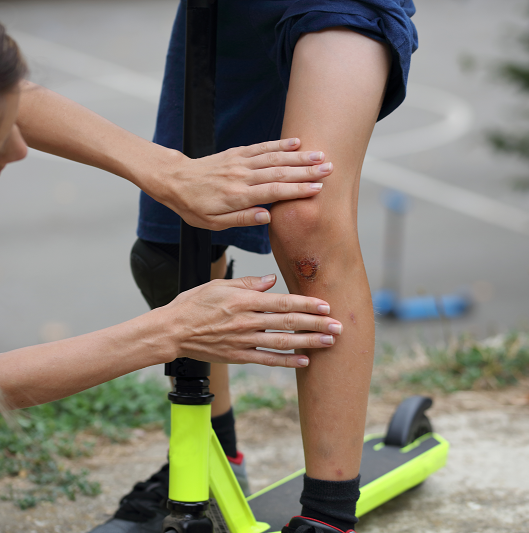 Boy injured his leg during scooter riding and mother treats her son skinned knee to prevent infection. 