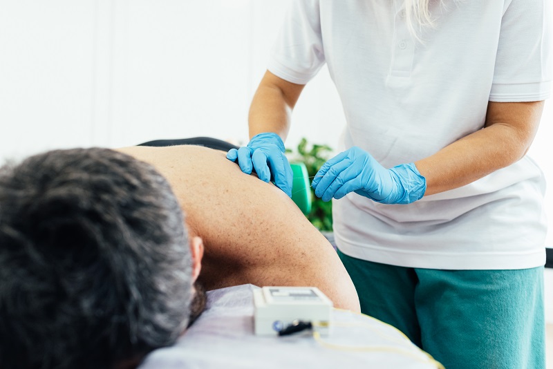 Physician administering dry needling therapy to patient laying on a table. Dry needling and cupping therapy.