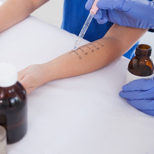 Doctor performing an allergy test on a young patient's arm.