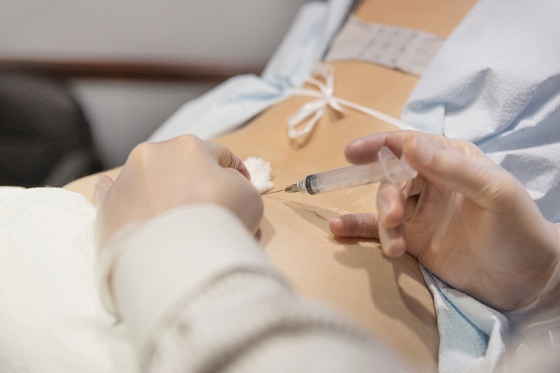 A doctor injects cortisone into a woman's back to relive pain.