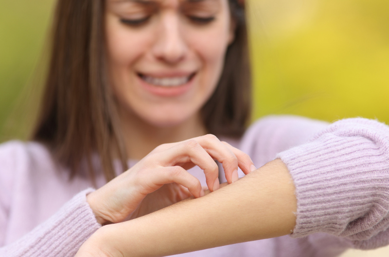 Stressed teen scratching itchy arm in a park.