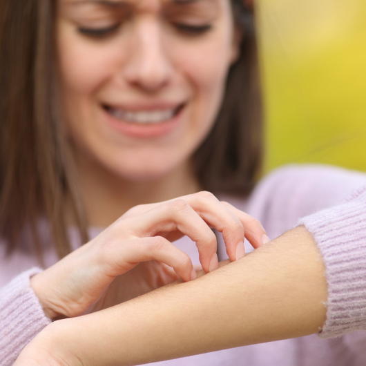 Stressed teen scratching itchy arm in a park.