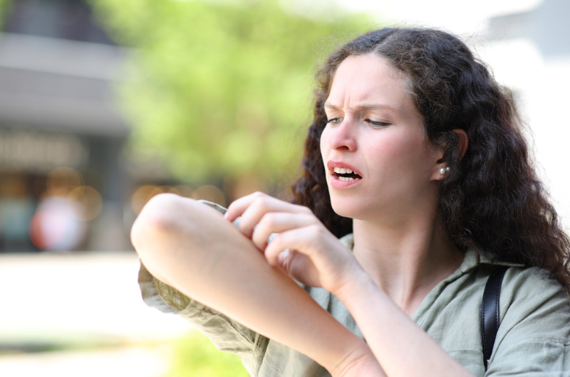 Stressed woman scratching arm in the street.