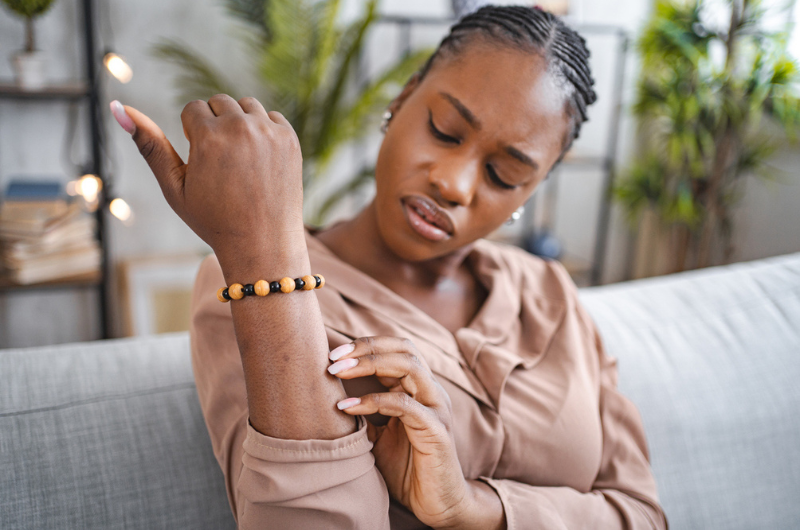 Black woman scratching her itchy skin on her forearm.