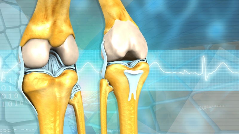 3D illustration of human knee anatomy.