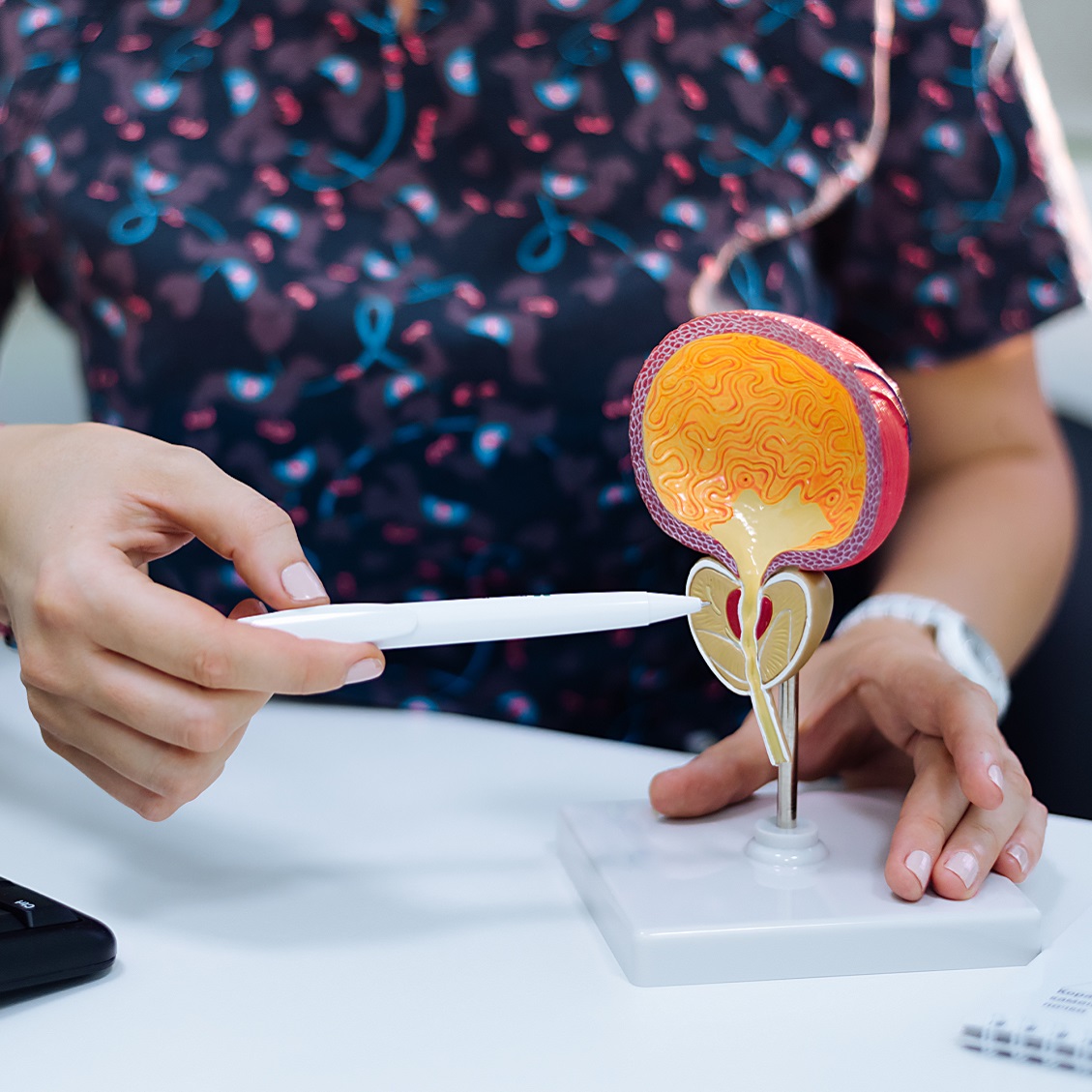 Doctor pointing to prostate on model