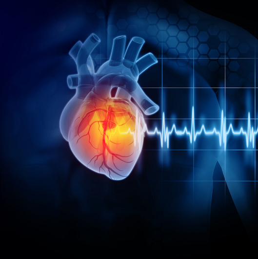 Illustration of cardiac arrest, a heart stopping