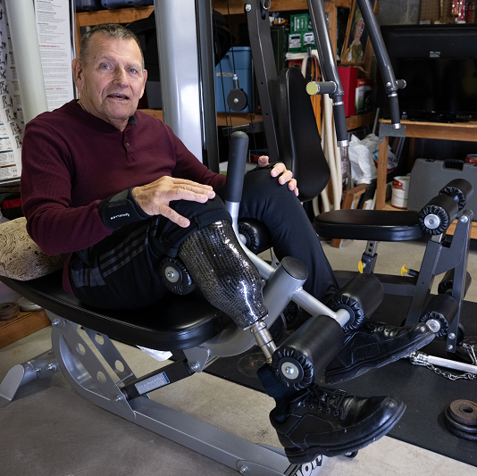 Bill Tarallo underwent a leg amputation while also receiving treatment for chronic lymphocytic leukemia at Hackensack University Medical Center.