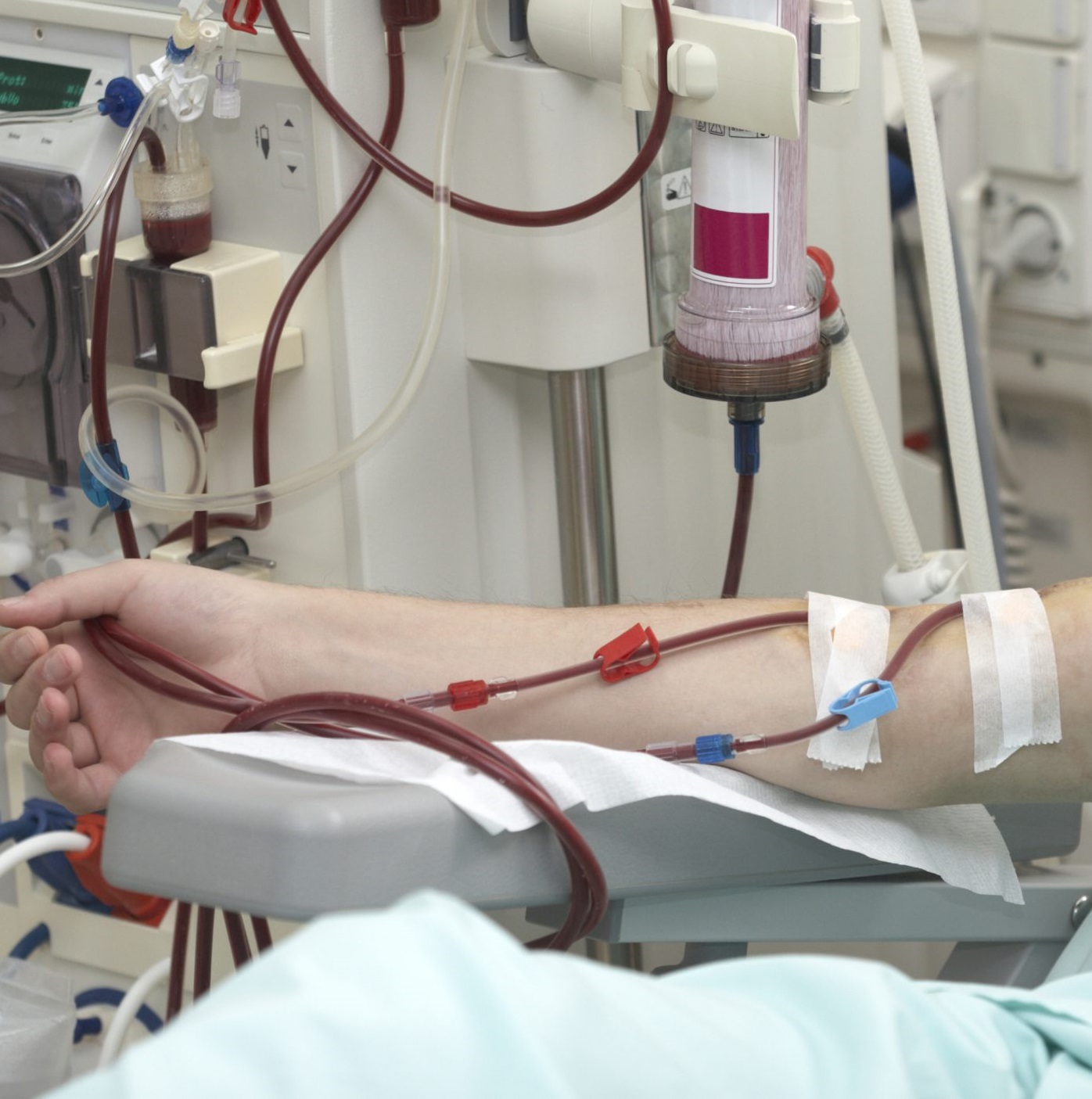 Person getting dialysis