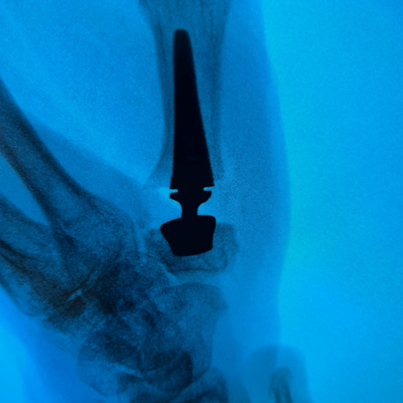 Surgical tool inserted into joint