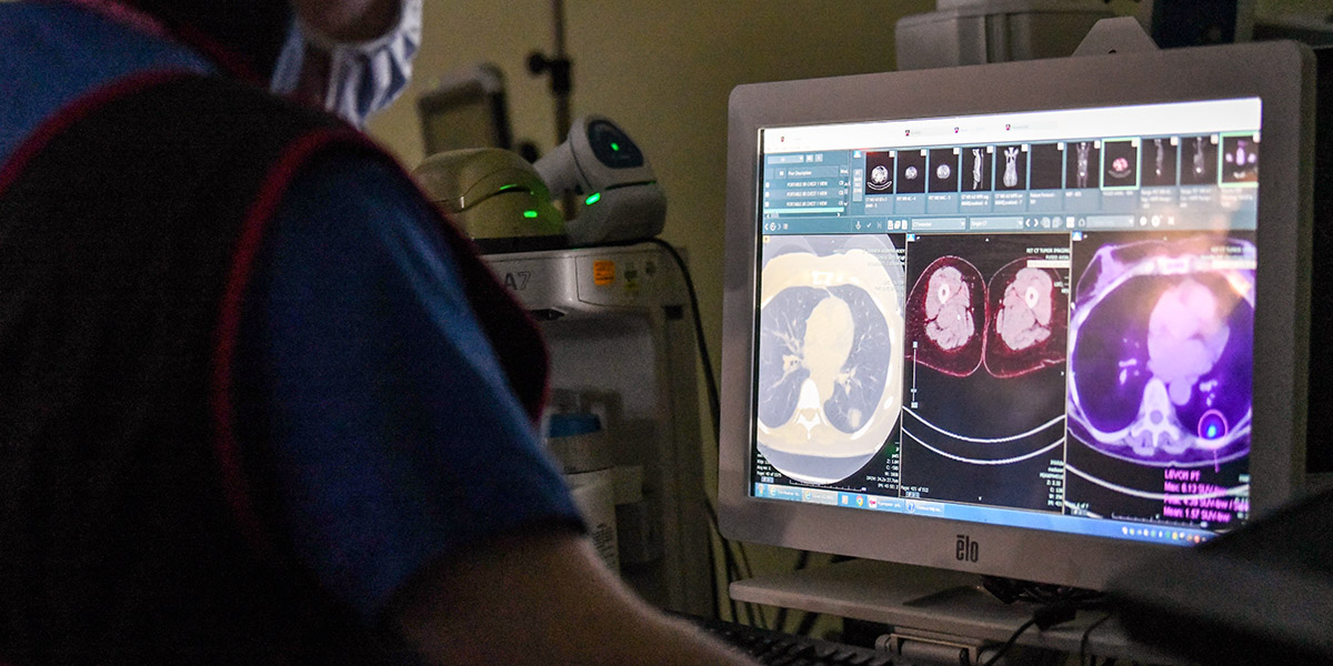 Lung Sparing Surgery