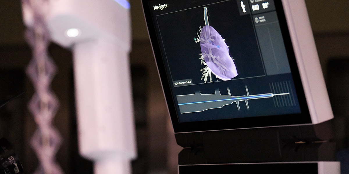 ION Software Performance