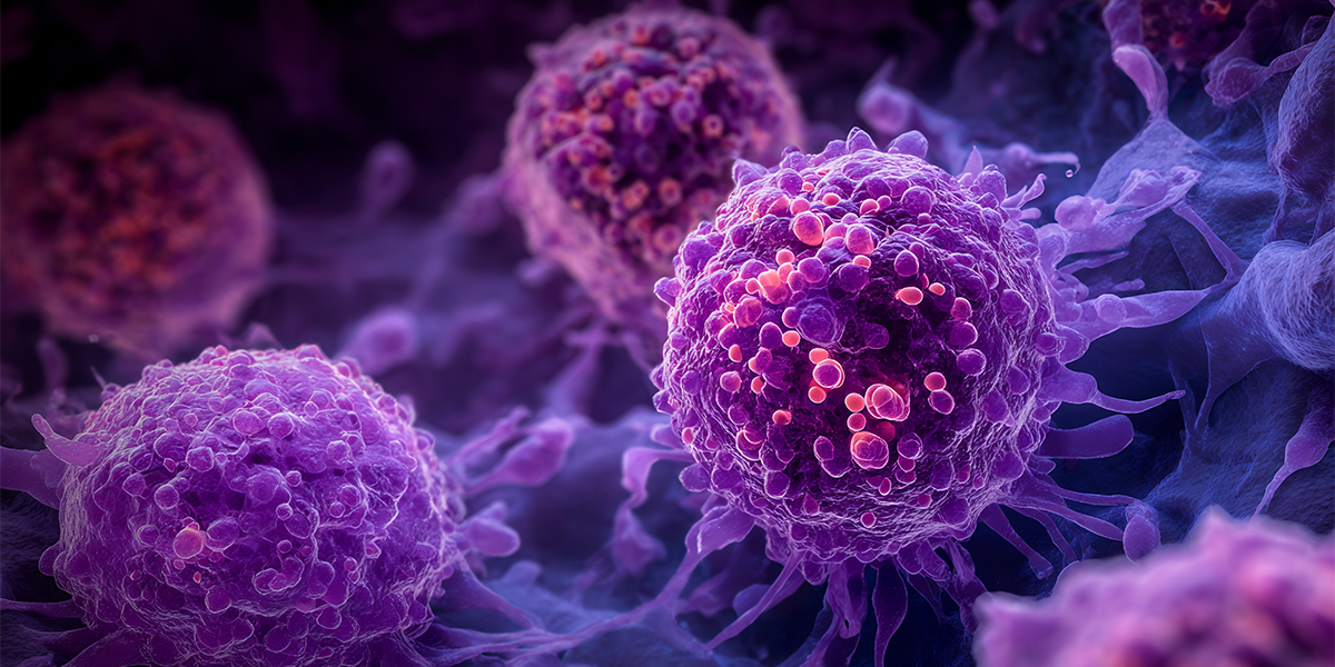 Pancreatic Cancer Screening