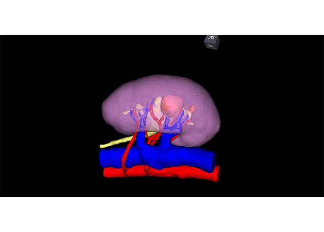Urology 3D Imaging