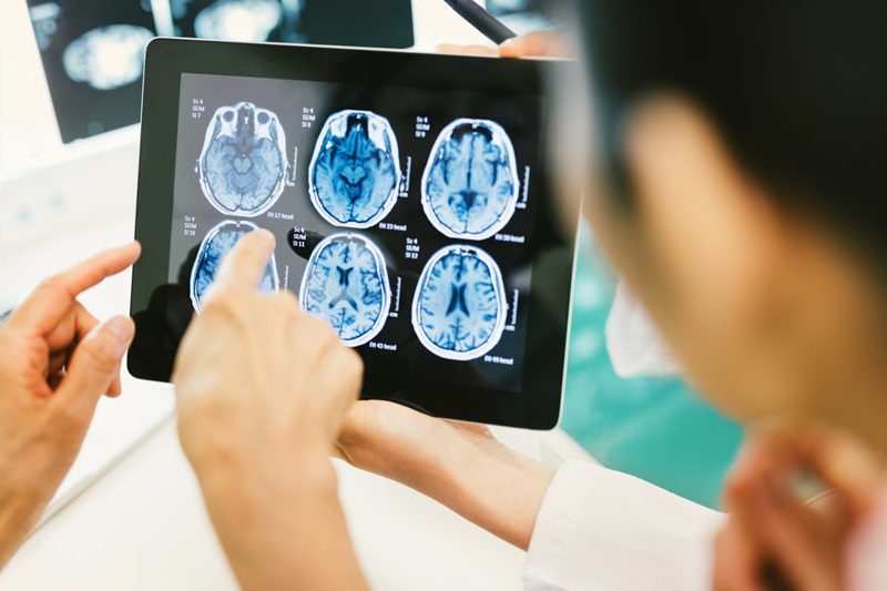 reviewing brain scan images for benign or malignant tumors