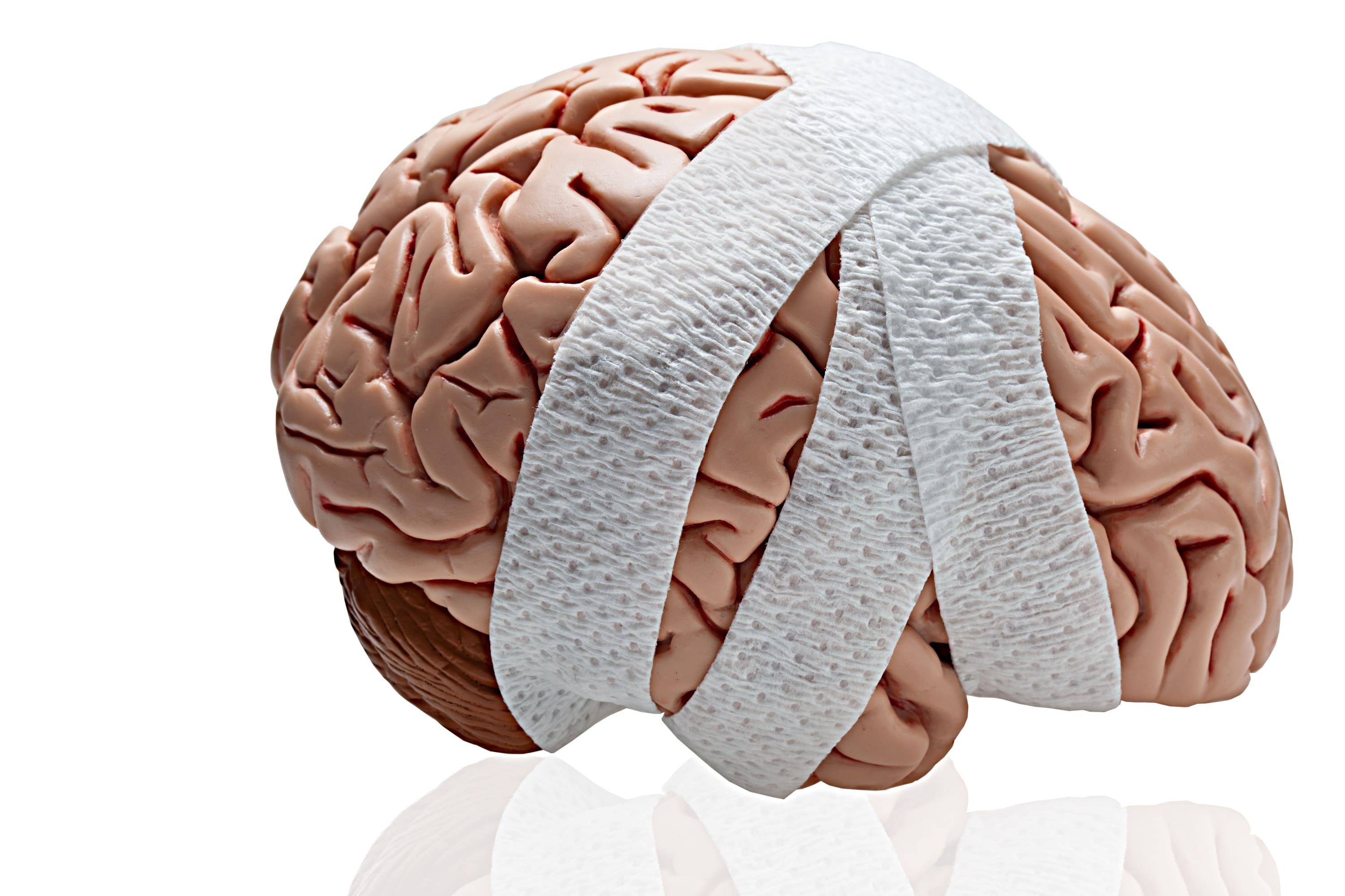 4 Steps to Recovery After a Brain Injury
