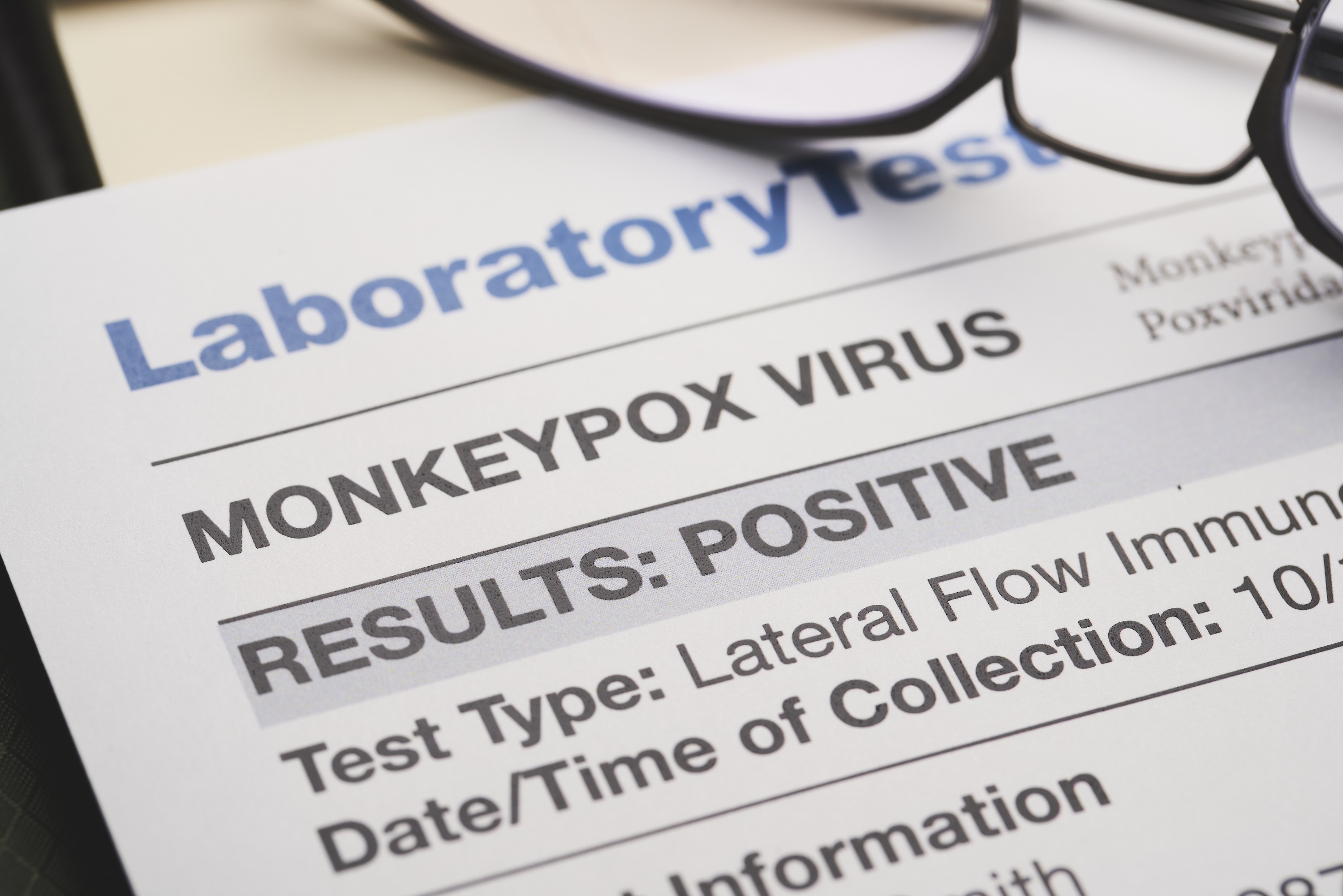 Lab test for monkey pox