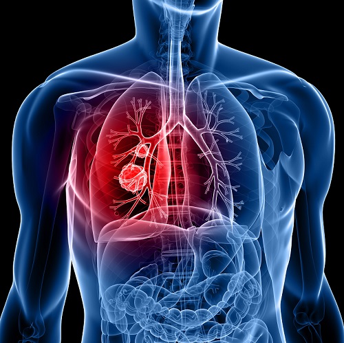 Thoracic Lung Conditions