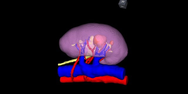 Urology 3D Imaging