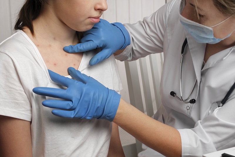 Doctor looking at the skin of a young girl with measles rashes. 