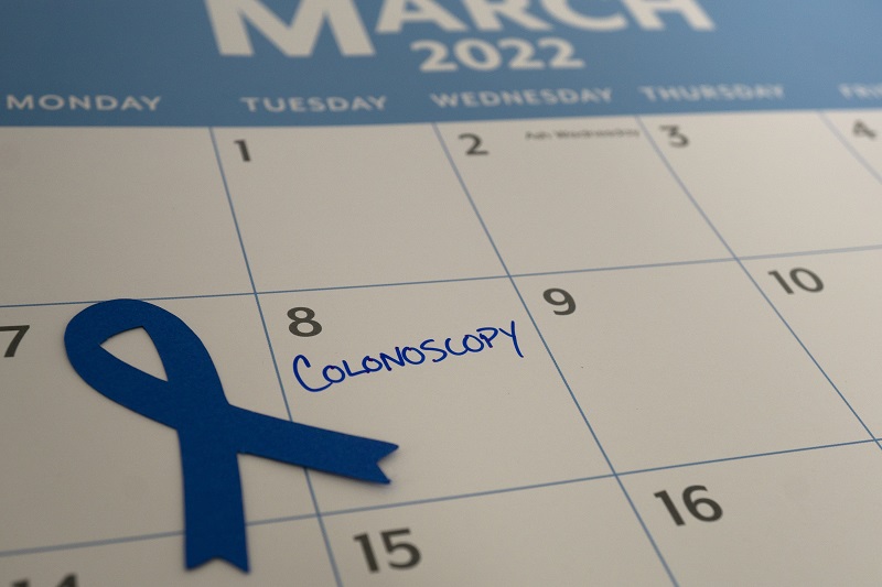 Calendar showing colonoscopy appointment