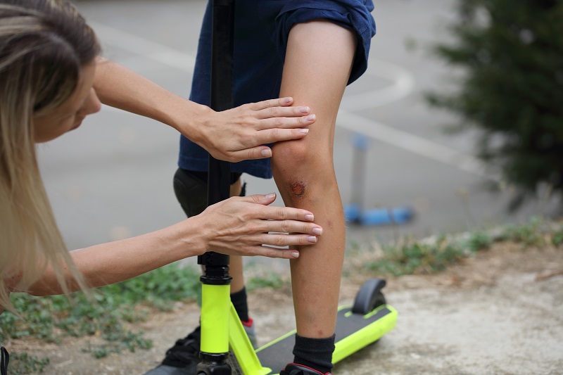 Boy injured his leg during scooter riding and mother treats her son skinned knee to prevent infection. 