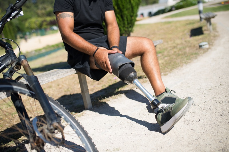 Man experiencing phantom limb pain in his amputated leg. 