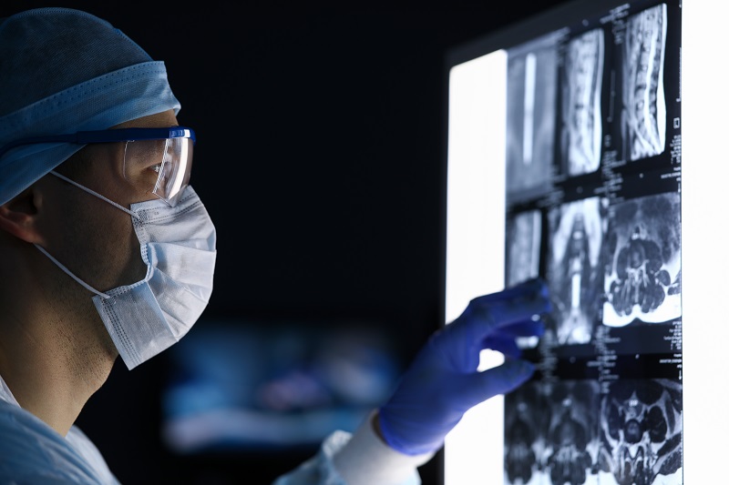 Surgeon looking at a scan of a tumor