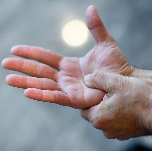 Is It Carpal Tunnel or Something Else?