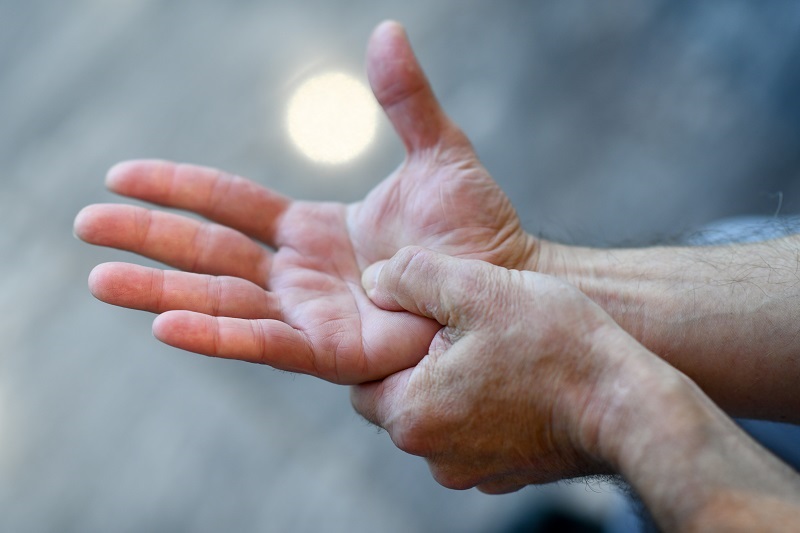 Close up of a man's hands, holding one hand in pain. 
