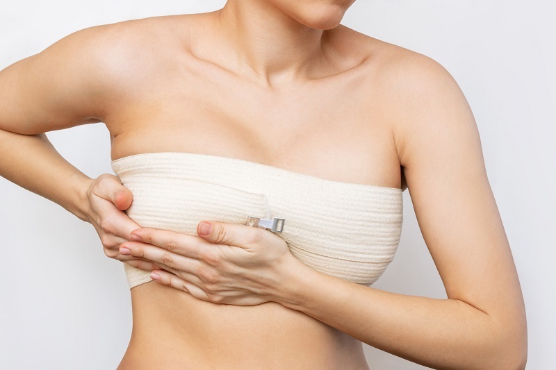 Breast Augmentation with Fat Transfer: How Does it Work?