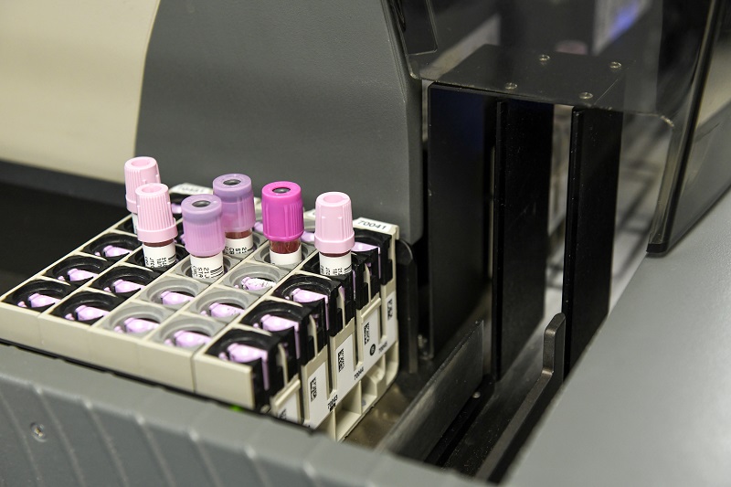 Vials in a lab for genetic testing.