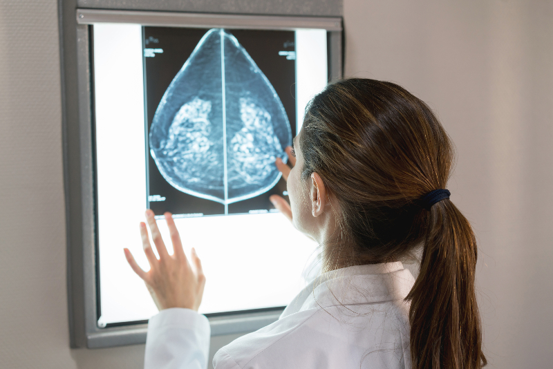 Doctor looking at dense breast mammogram