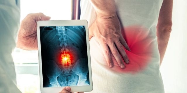 Nonsurgical Spine Care