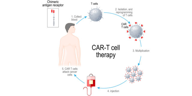 T Cell Therapy